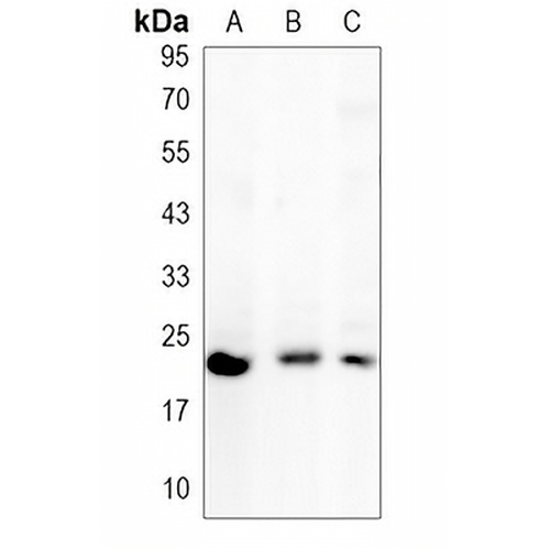 RAC1/2/3 Rabbit Monoclonal Antibody(C1530)