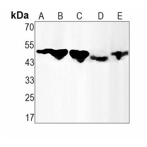 Alpha-1A Adrenergic Receptor Rabbit Monoclonal Antibody(C1533)