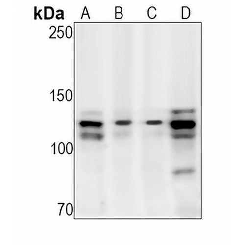 TAOK1/2/3 (Phospho-S181/S177) Rabbit Monoclonal Antibody(C1536)