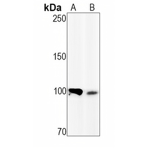 Nucleolin (Phospho-T84) Rabbit Monoclonal Antibody(C1537)