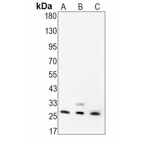 BCL2 Rabbit Monoclonal Antibody(C1538)