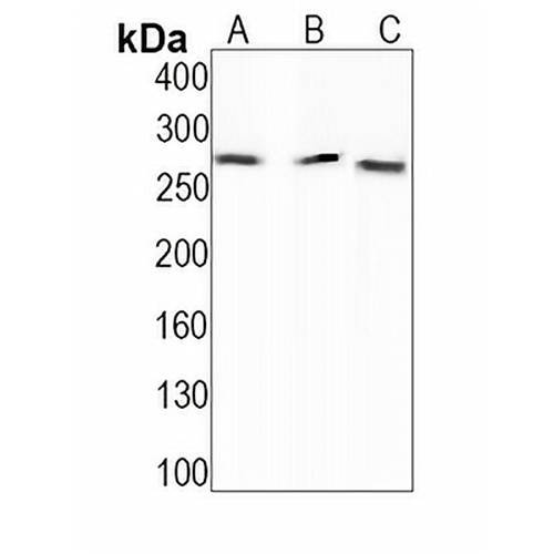 ACC alpha (Phospho-S79) Rabbit Monoclonal Antibody(C1542)