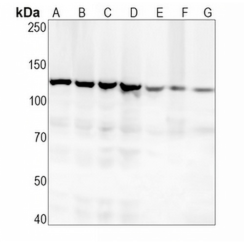 Vinculin Rabbit Monoclonal Antibody(C1544)