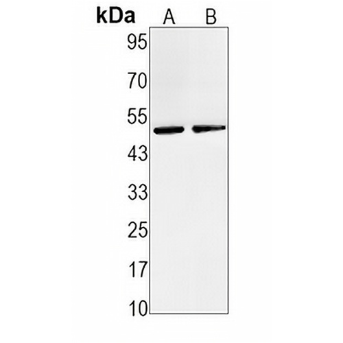 MMP3 Rabbit Monoclonal Antibody(C1545)