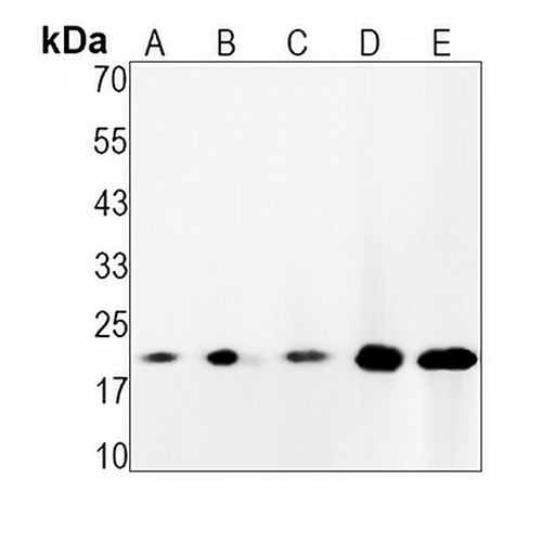 H-Ras Rabbit Monoclonal Antibody(C1546)