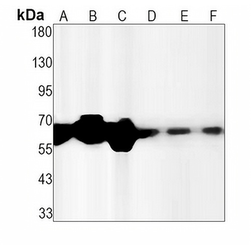 MMP14 Rabbit Monoclonal Antibody(C1548)