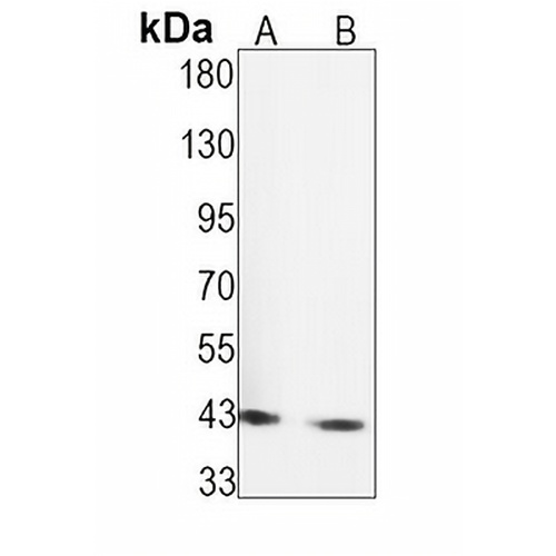 c-Jun Rabbit Monoclonal Antibody(C1549)