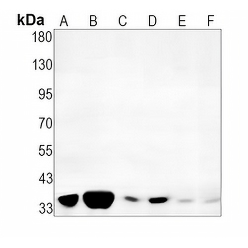 CDK1/2/3 (Phospho-T14) Rabbit Monoclonal Antibody(C1550)