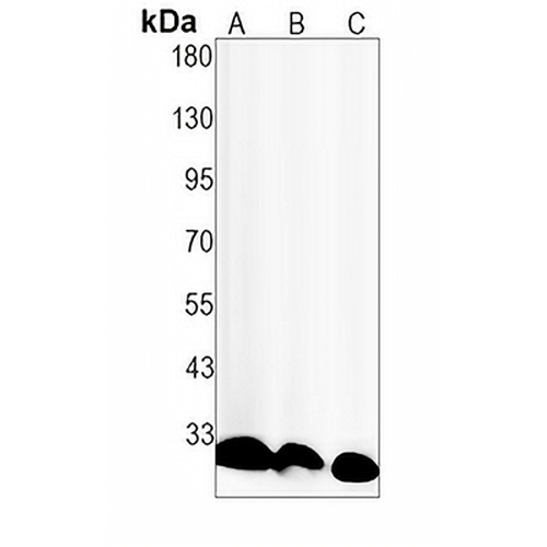 Histone H1 (Phospho-T17) Rabbit Monoclonal Antibody(C1556)