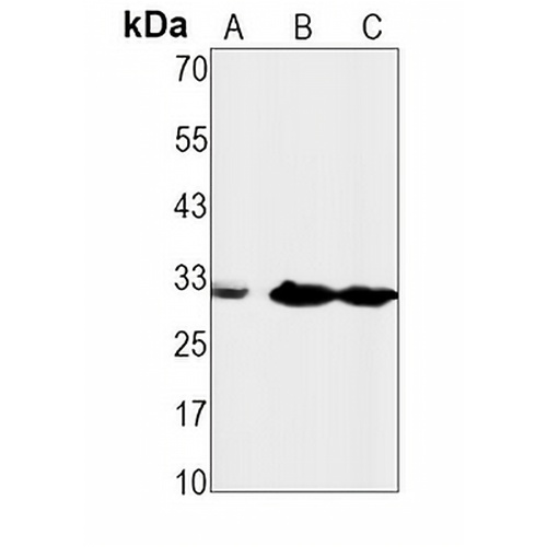 CD8 Rabbit Monoclonal Antibody(C1557)