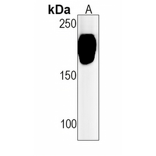 CD11a Rabbit Monoclonal Antibody(C1558)