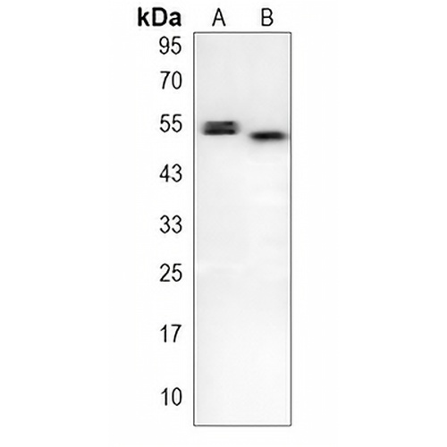 CHK1 Rabbit Monoclonal Antibody(C1559)