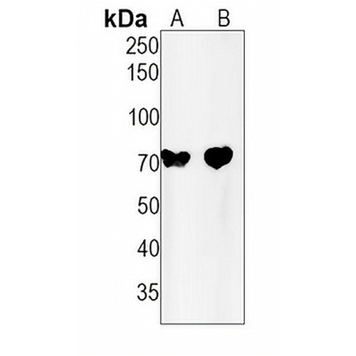 TAU (Phospho-S713/396) Rabbit Monoclonal Antibody(C1560)
