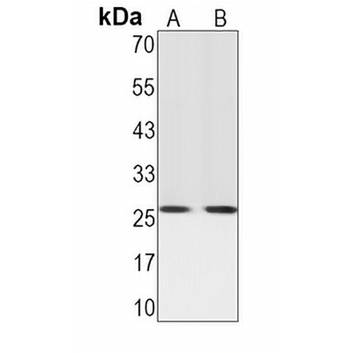 CD81 Rabbit Monoclonal Antibody(C1563)
