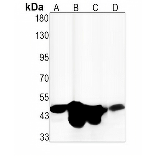 CD38 Rabbit Monoclonal Antibody(C1564)