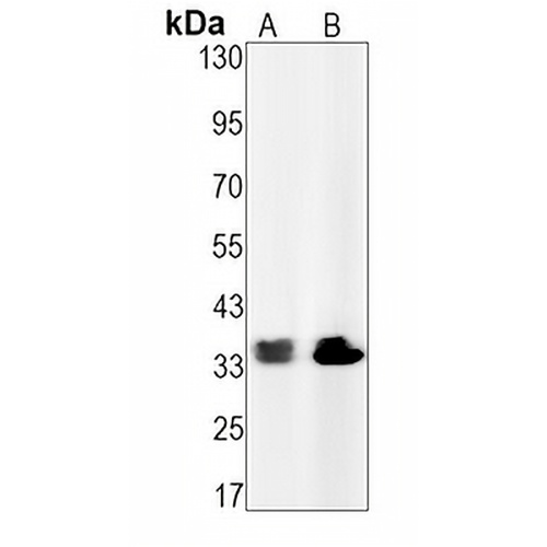 CDK2 (Phospho-Y15) Rabbit Monoclonal Antibody(C1565)