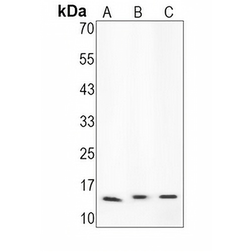 FN14 Rabbit Monoclonal Antibody(C1567)
