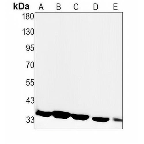 CDK4 Rabbit Monoclonal Antibody(C1569)