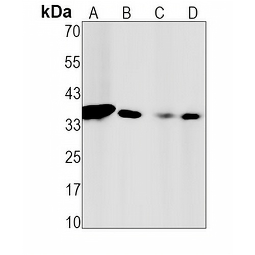 Caspase 6 Rabbit Monoclonal Antibody(C1570)