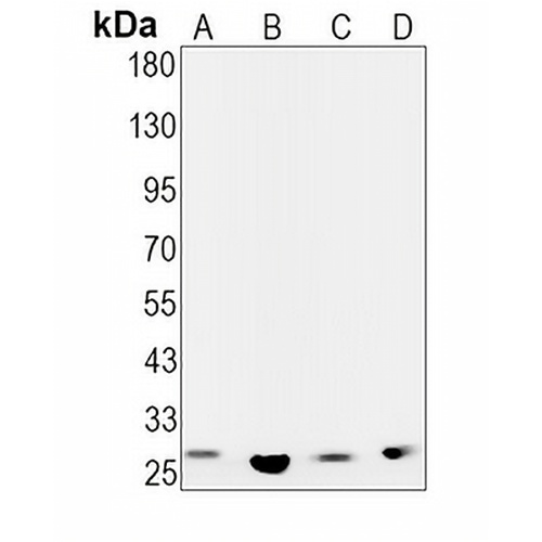 CDCA3 Rabbit Monoclonal Antibody(C1573)
