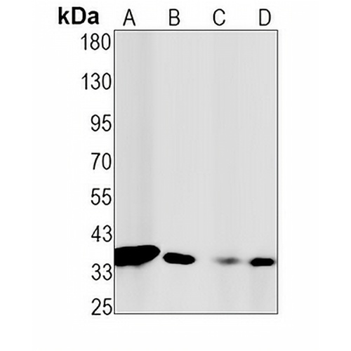 CDC34 Rabbit Monoclonal Antibody(C1574)