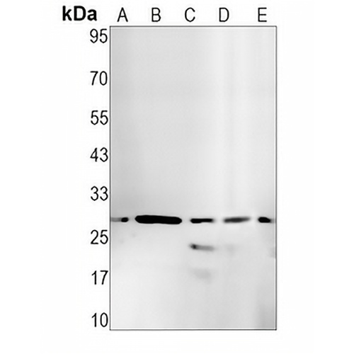 Caspase 14 Rabbit Monoclonal Antibody(C1575)
