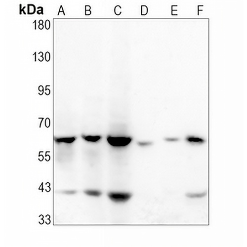 CD147 Rabbit Monoclonal Antibody(C1577)
