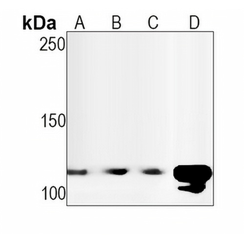 CD62P Rabbit Monoclonal Antibody(C1578)