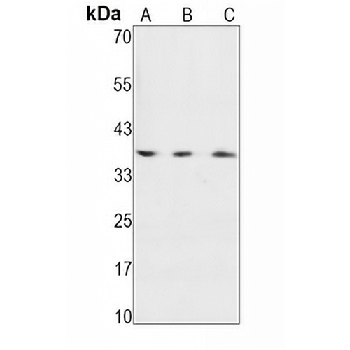 IKB alpha (Phospho-S36) Rabbit Monoclonal Antibody(C1580)