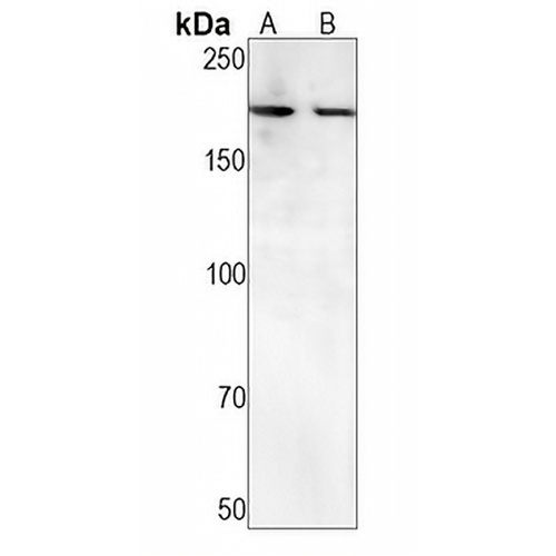 ATAD2 Rabbit Monoclonal Antibody(C1581)