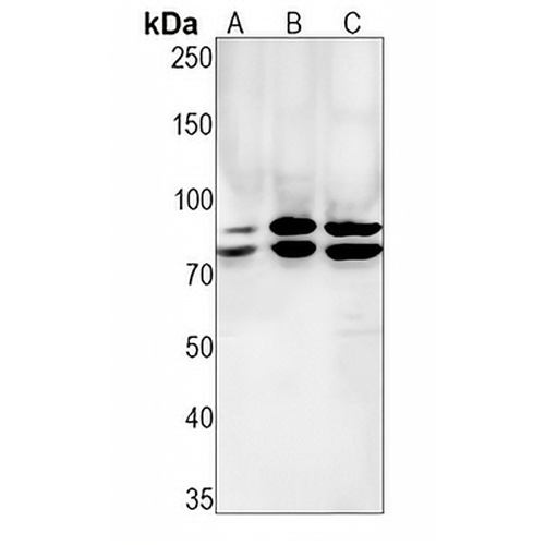 DDX17 Rabbit Monoclonal Antibody(C1582)