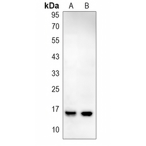 PBR Rabbit Monoclonal Antibody(C1583)