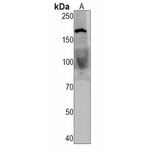 NUP153 Rabbit Monoclonal Antibody(C1584)