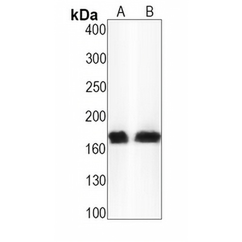 LRP6 (Phospho-S1490) Rabbit Monoclonal Antibody(C1585)