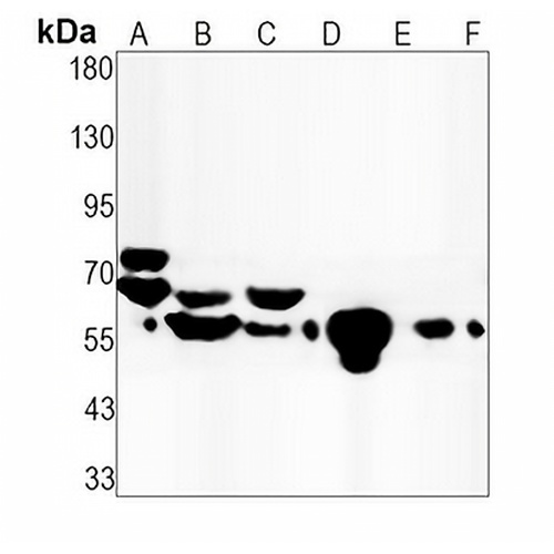 Lamin A/C Rabbit Monoclonal Antibody(C1586)