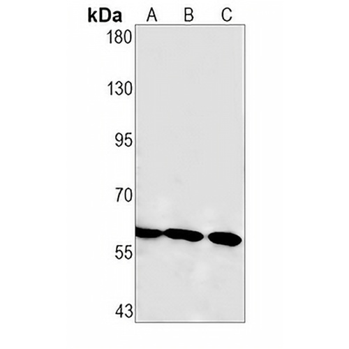 SMAD4 Rabbit Monoclonal Antibody(C1589)