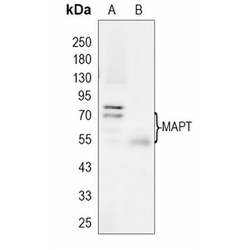 TAU Rabbit Monoclonal Antibody(C1590)