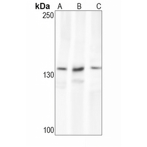APAF-1 Rabbit Monoclonal Antibody(C1598)