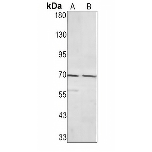 Caldesmon Rabbit Monoclonal Antibody(C1601)
