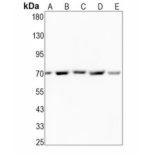 HSC70 Rabbit Monoclonal Antibody(C1603)