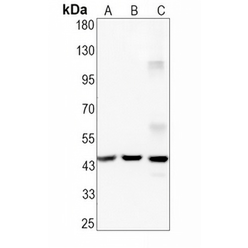 CABP1 Rabbit Monoclonal Antibody(C1605)