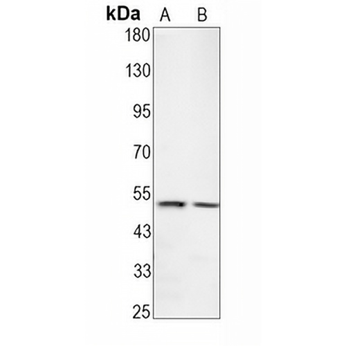 TPH1 Rabbit Monoclonal Antibody(C1607)