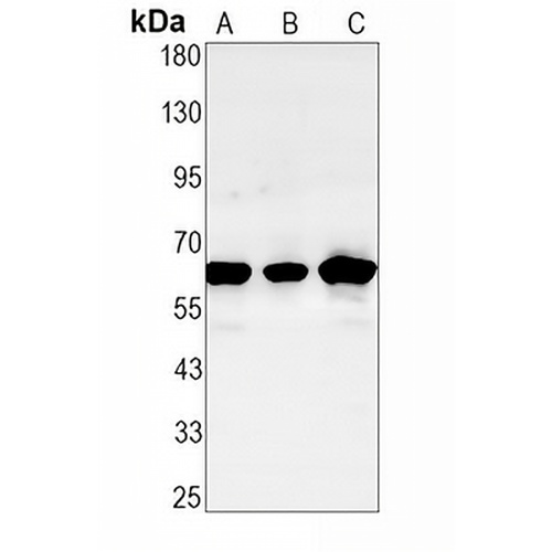 CHK2 Rabbit Monoclonal Antibody(C1608)