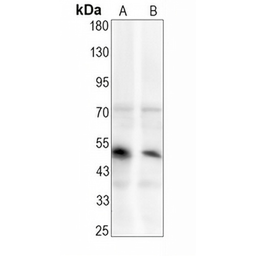 SMAD1/5/9 (Phospho-S463/S465) Rabbit Monoclonal Antibody(C1610)