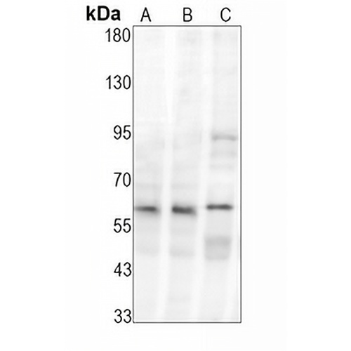 SMAD1 Rabbit Monoclonal Antibody(C1611)