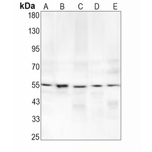 ATF4 Rabbit Monoclonal Antibody(C1612)