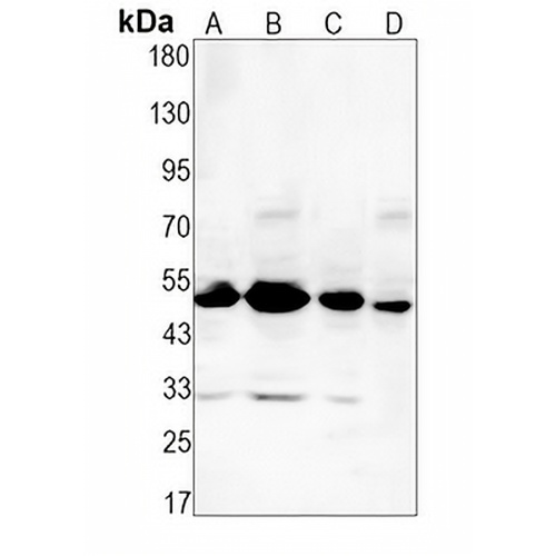 CDC37 Rabbit Monoclonal Antibody(C1613)