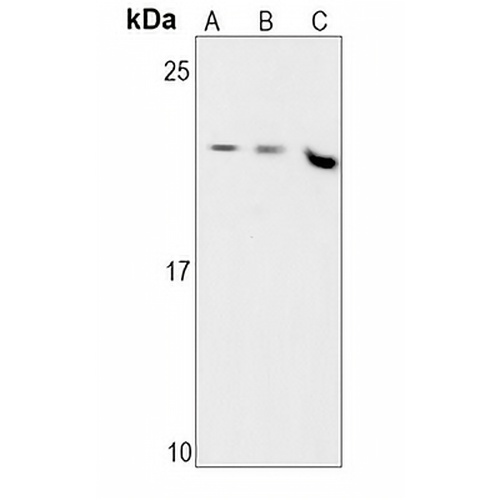 MGMT Rabbit Monoclonal Antibody(C1614)