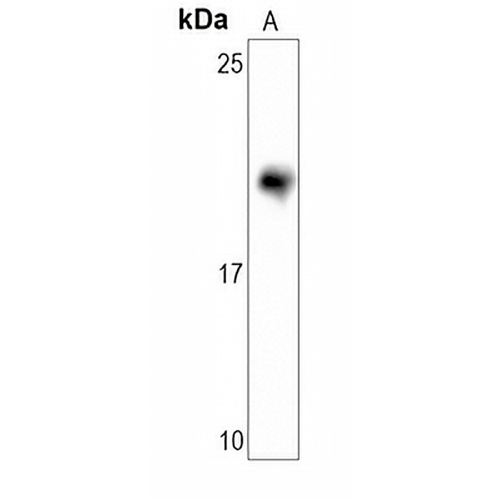CD3d Rabbit Monoclonal Antibody(C1615)