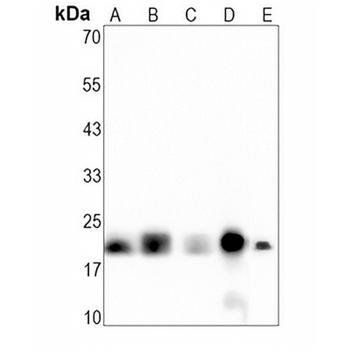 4EBP1 Rabbit Monoclonal Antibody(C1616)